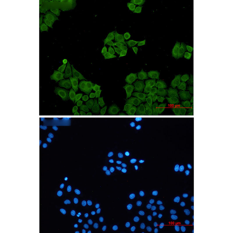 CLIC1 Rabbit Monoclonal Antibody