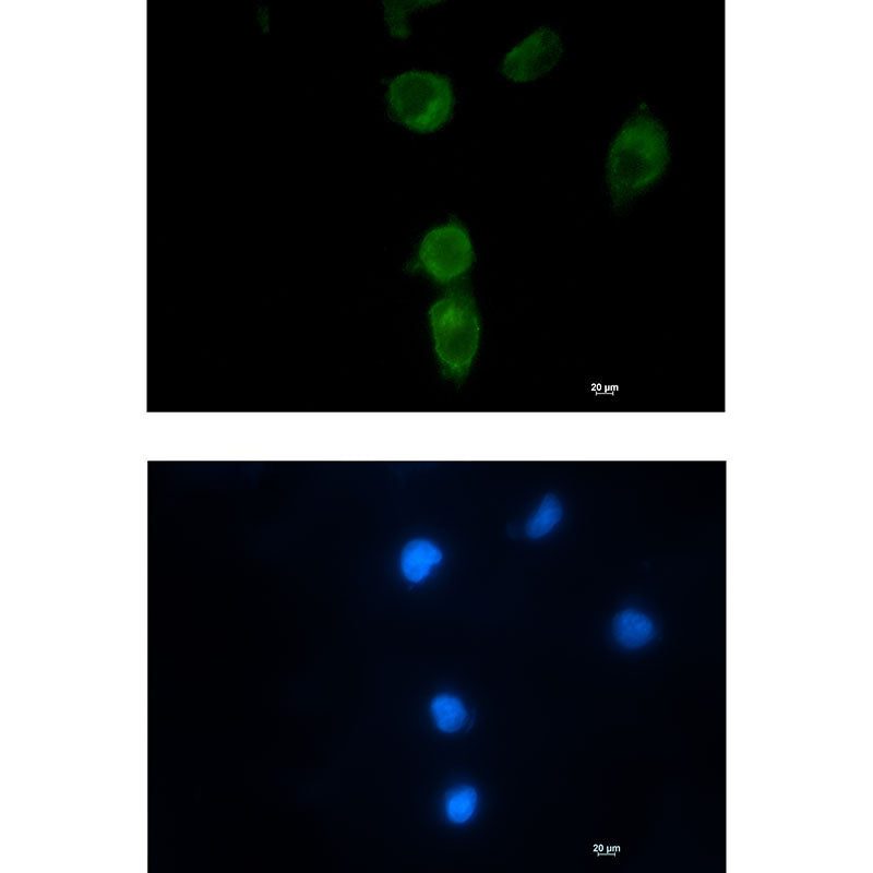 CLPX Rabbit Monoclonal Antibody