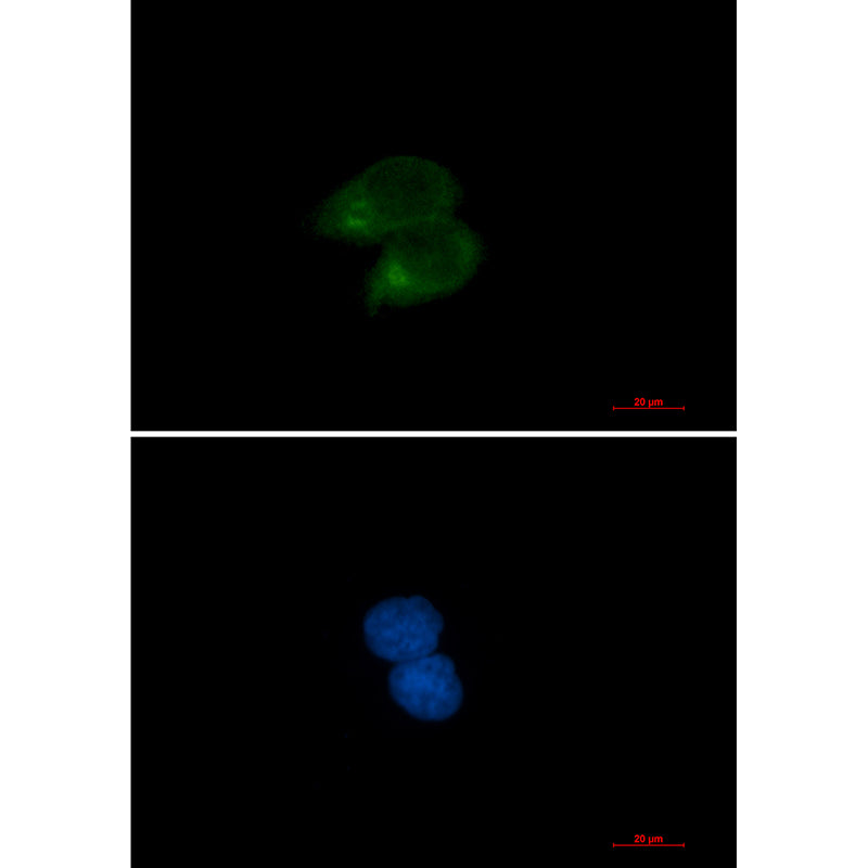 CLSTN1 Rabbit Monoclonal Antibody