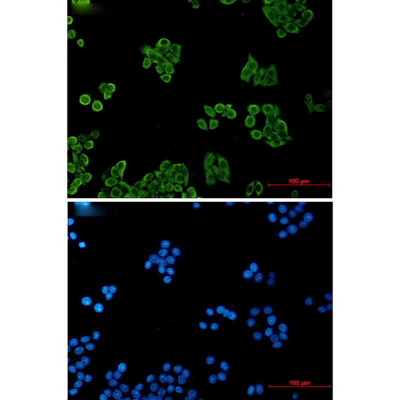CSDE1 Rabbit Monoclonal Antibody
