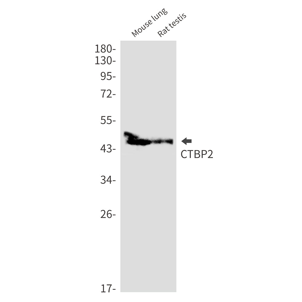 CTBP2 Rabbit Monoclonal Antibody