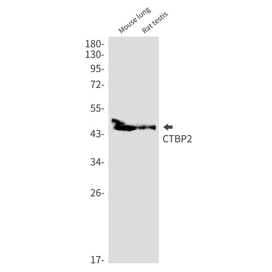 CTBP2 Rabbit Monoclonal Antibody