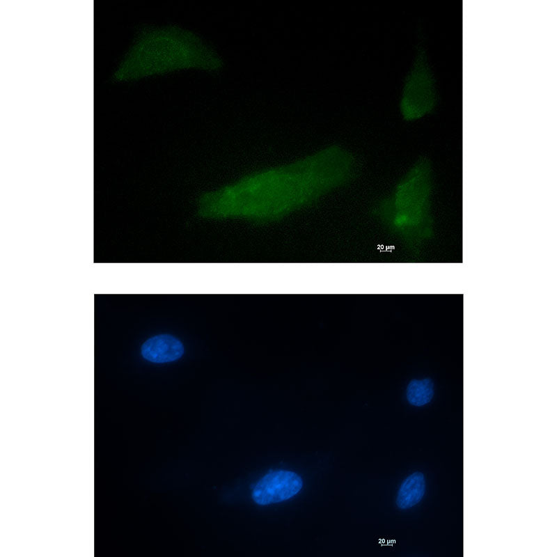 CUG BP1 Rabbit Monoclonal Antibody