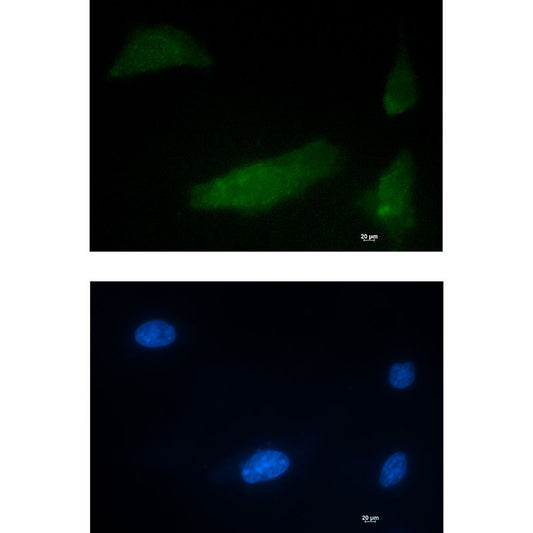 CUG BP1 Rabbit Monoclonal Antibody