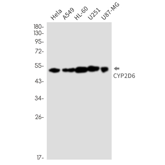Cytochrome P450 2D6 Rabbit Monoclonal Antibody