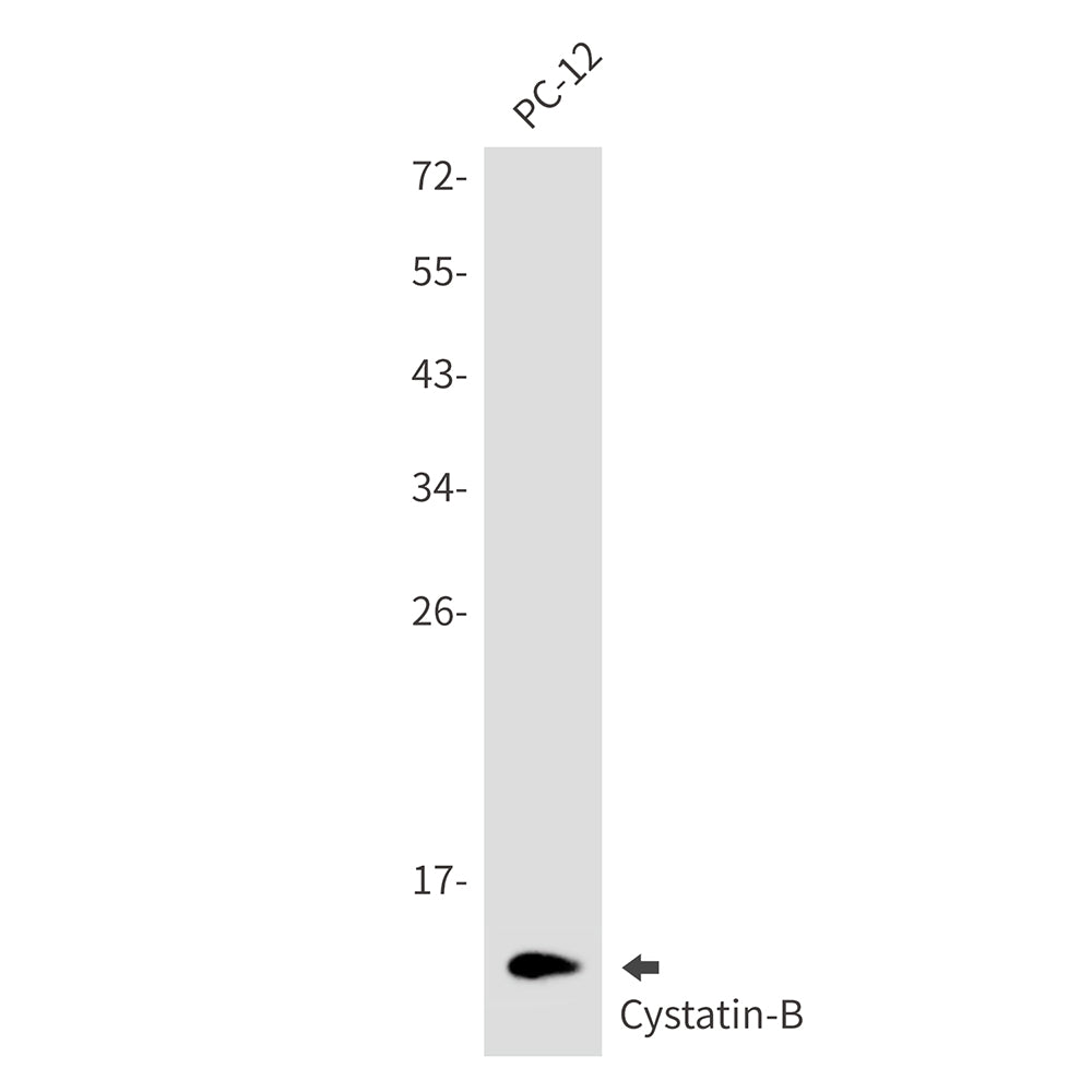 Cystatin B Rabbit Monoclonal Antibody