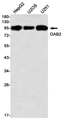 DAB2 Rabbit Monoclonal Antibody