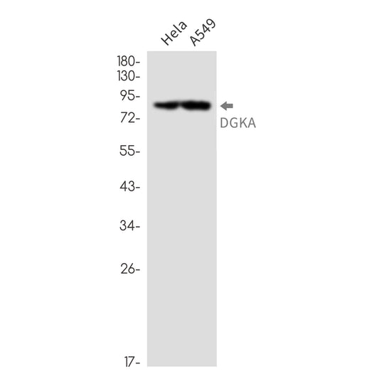 DGKA Rabbit Monoclonal Antibody