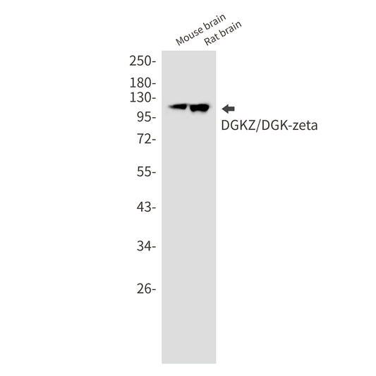 DGKZ Rabbit Monoclonal Antibody