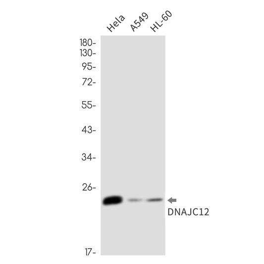 DNAJC12 Rabbit Monoclonal Antibody