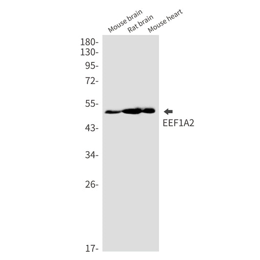Elongation Factor 1A2 Rabbit Monoclonal Antibody
