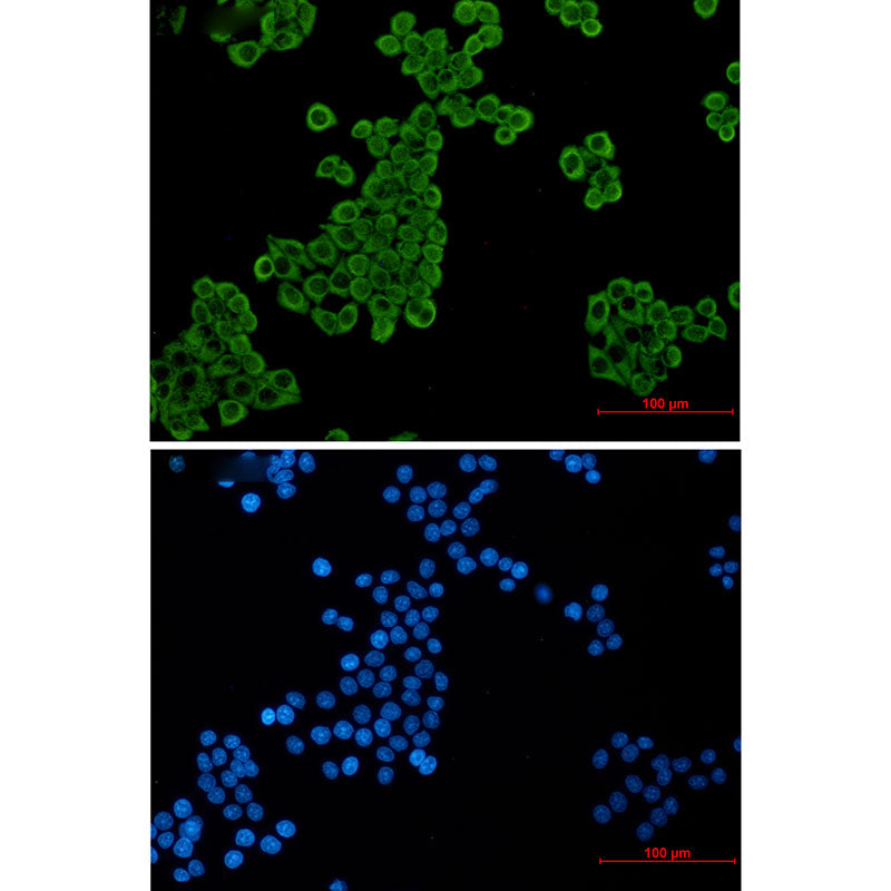 Elongation factor 2 Rabbit Monoclonal Antibody