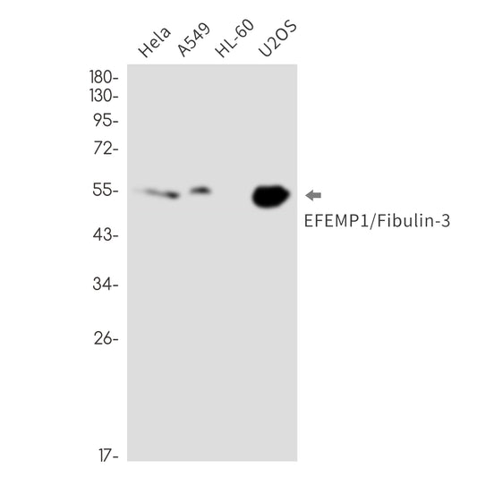 EFEMP1 Rabbit Monoclonal Antibody