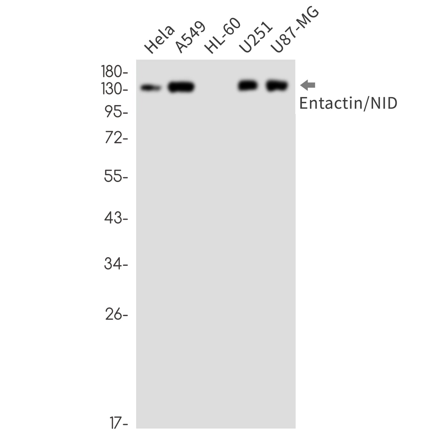 Entactin Rabbit Monoclonal Antibody