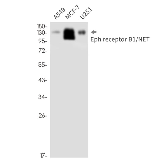Ephrin Receptor B1 Rabbit Monoclonal Antibody