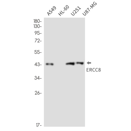 ERCC8 Rabbit Monoclonal Antibody