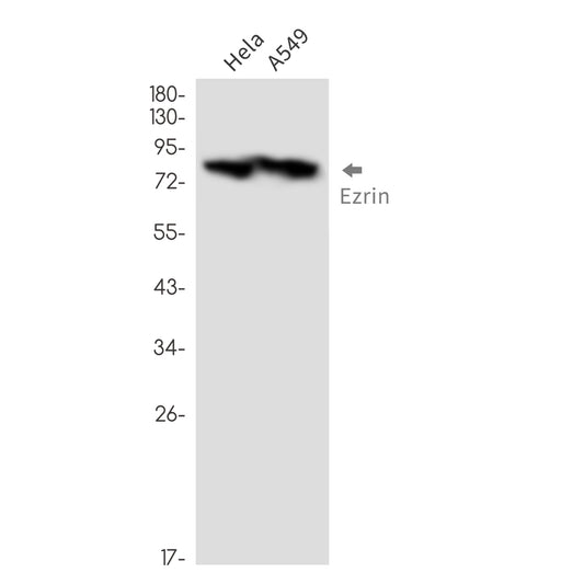 Ezrin Rabbit Monoclonal Antibody