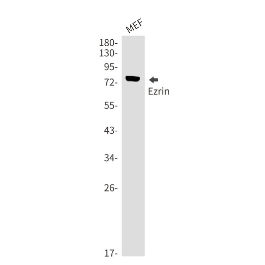 Ezrin Rabbit Monoclonal Antibody