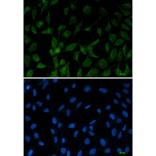 FE65 Rabbit Monoclonal Antibody