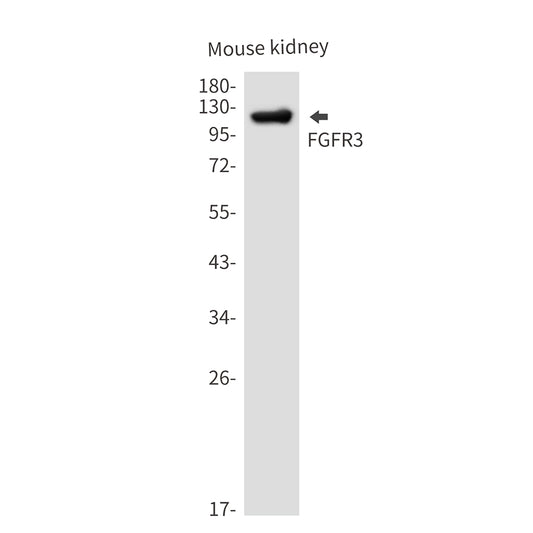 FGFR3 Rabbit Monoclonal Antibody