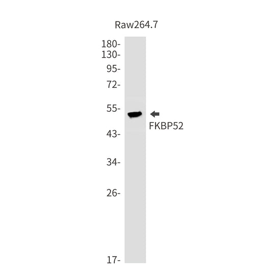 FKBP52 Rabbit Monoclonal Antibody