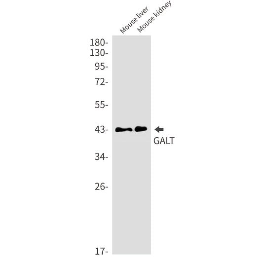 GALT Rabbit Monoclonal Antibody
