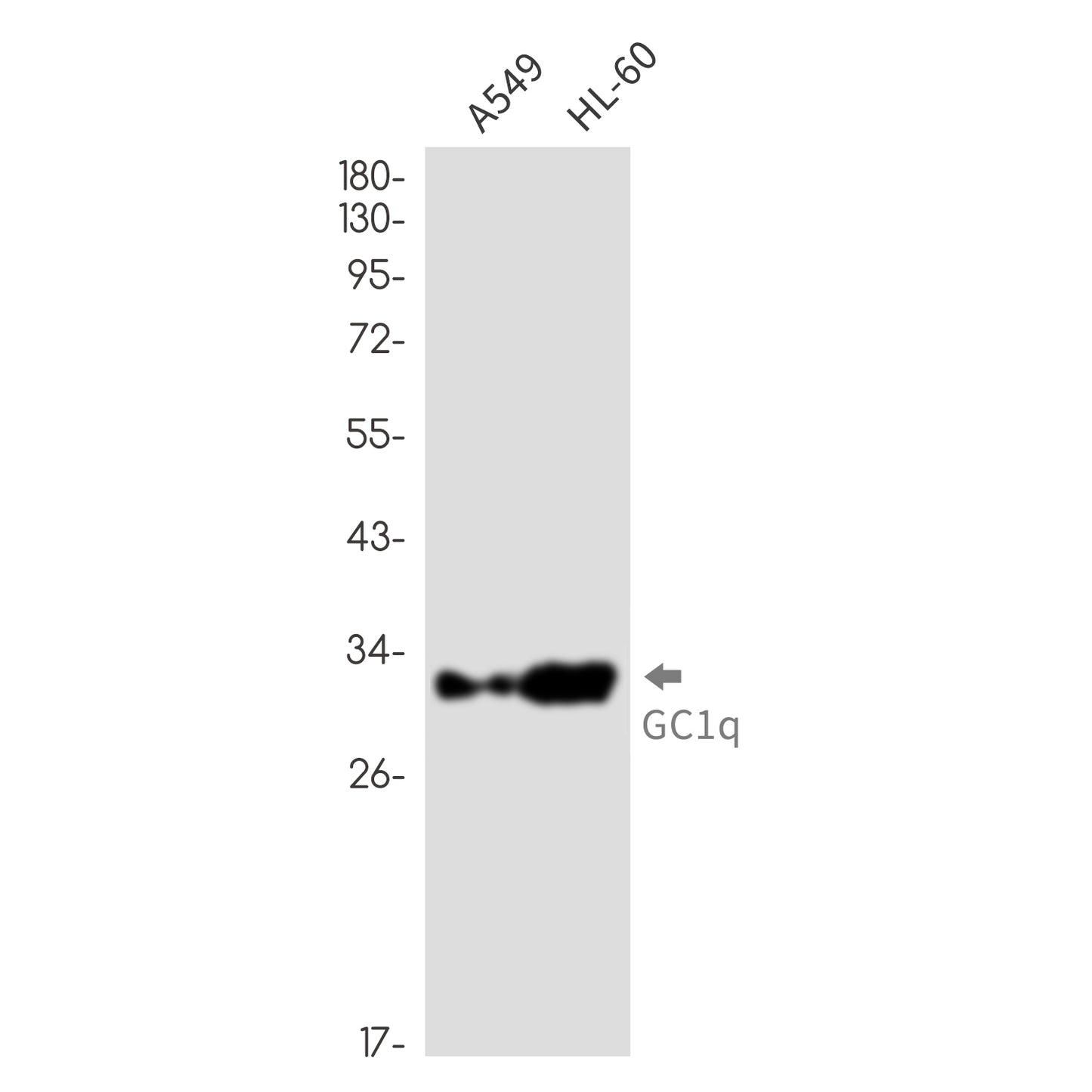 GC1q R Rabbit Monoclonal Antibody