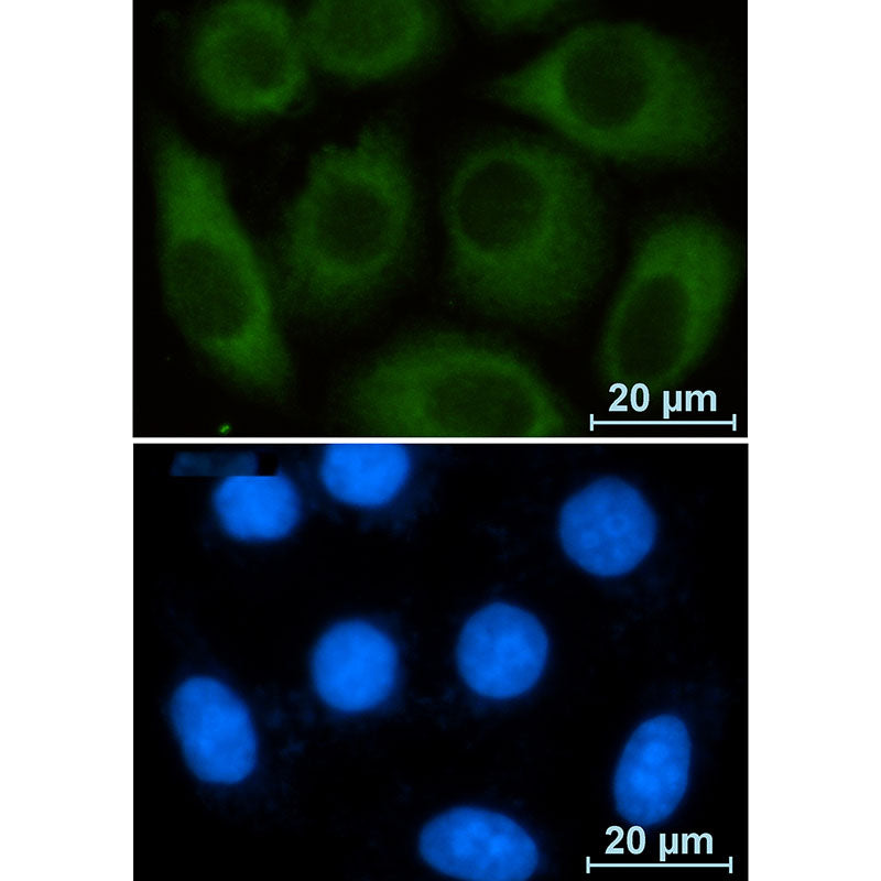 Glucose 6 Phosphate Dehydrogenase Rabbit Monoclonal Antibody