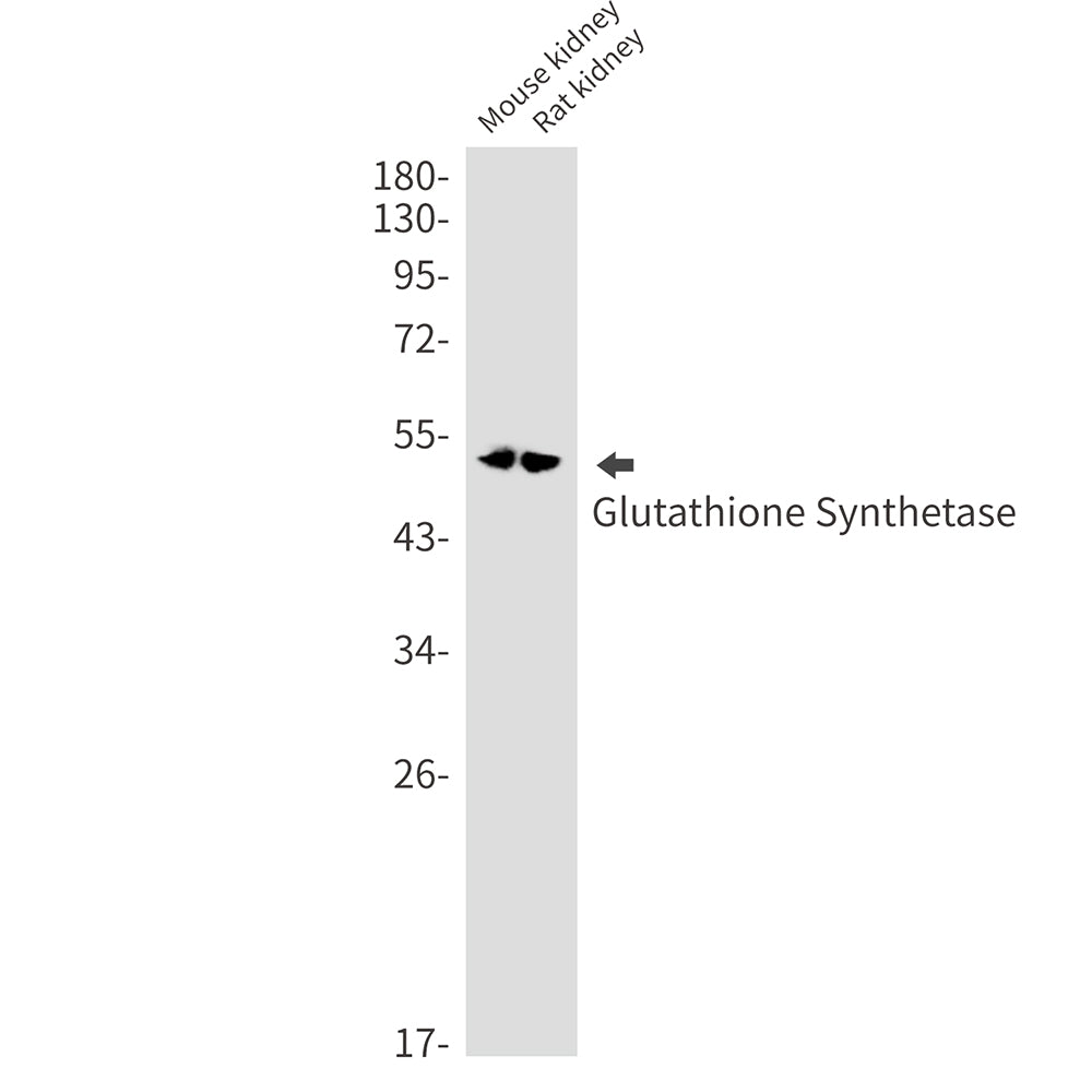 Glutathione Synthetase Rabbit Monoclonal Antibody