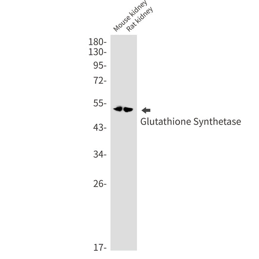 Glutathione Synthetase Rabbit Monoclonal Antibody