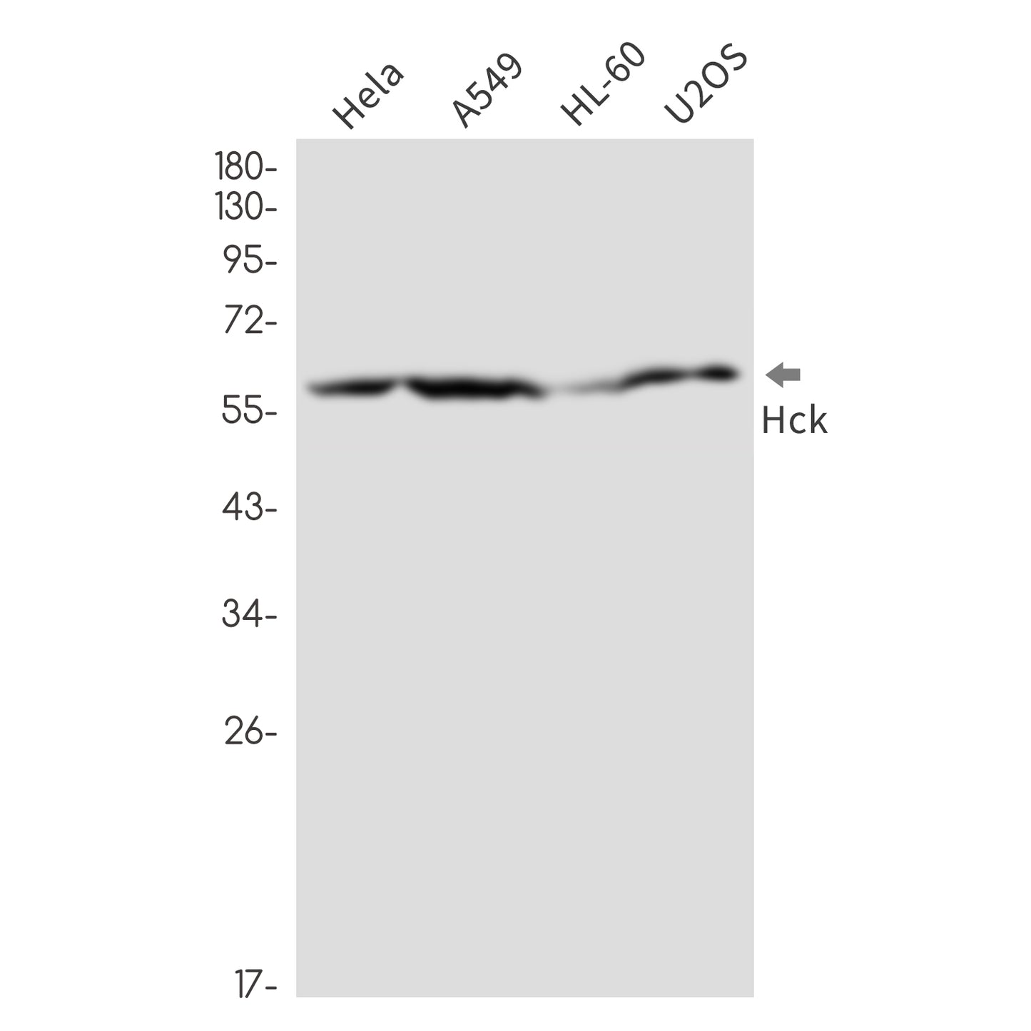 Tyrosine Protein Kinase HCK Rabbit Monoclonal Antibody