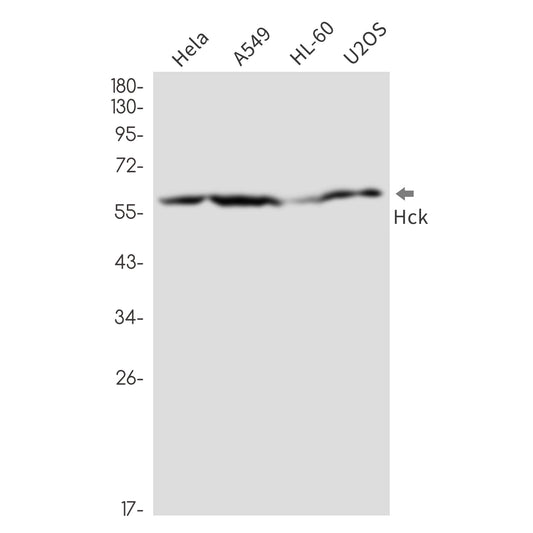 Tyrosine Protein Kinase HCK Rabbit Monoclonal Antibody