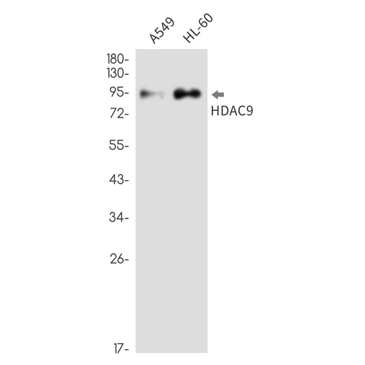 HDAC9 Rabbit Monoclonal Antibody