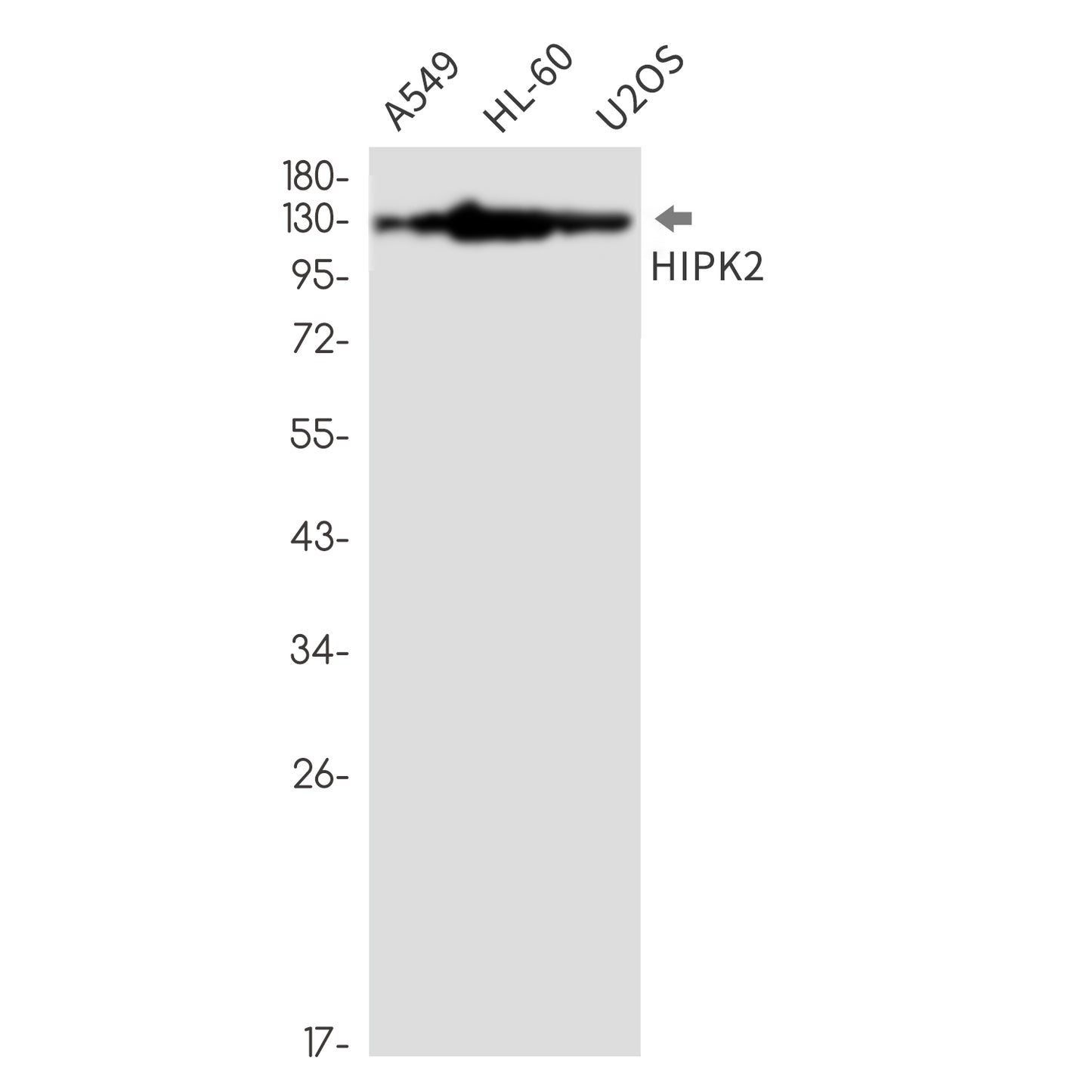 HIPK2 Rabbit Monoclonal Antibody