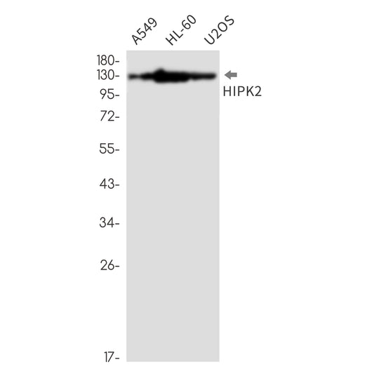HIPK2 Rabbit Monoclonal Antibody
