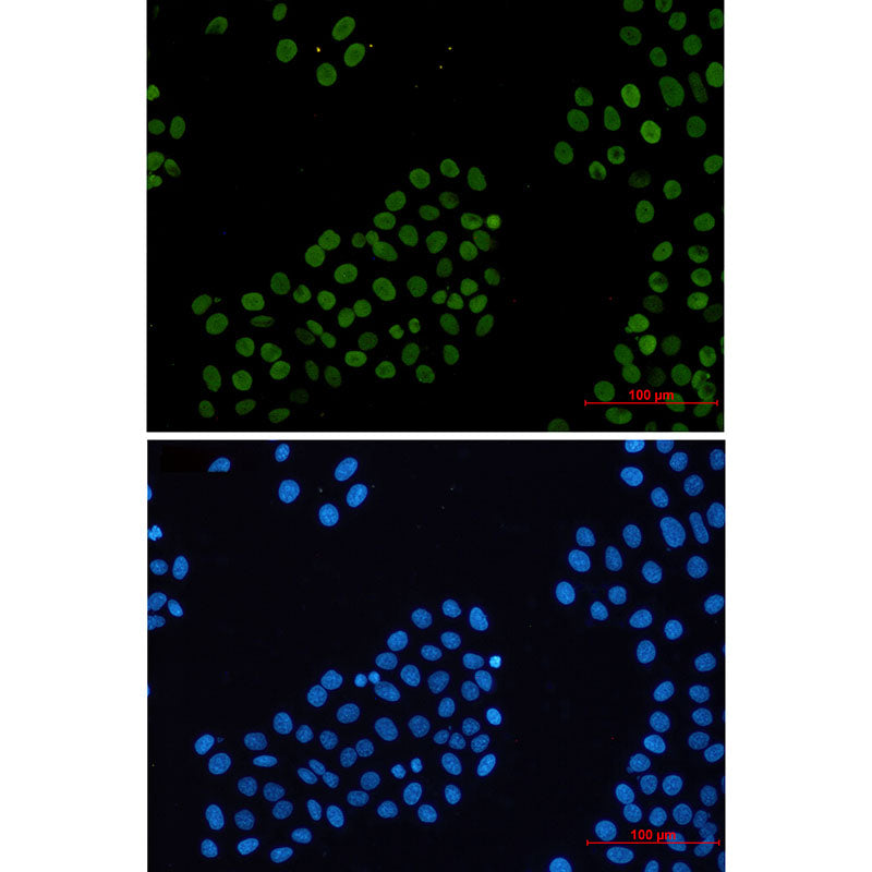 Histone H2A.X Rabbit Monoclonal Antibody