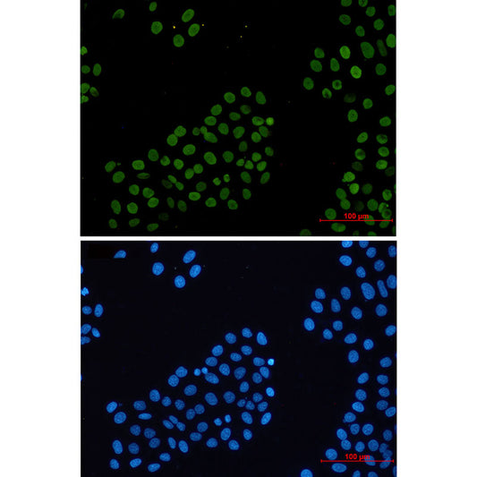 Histone H2A.X Rabbit Monoclonal Antibody