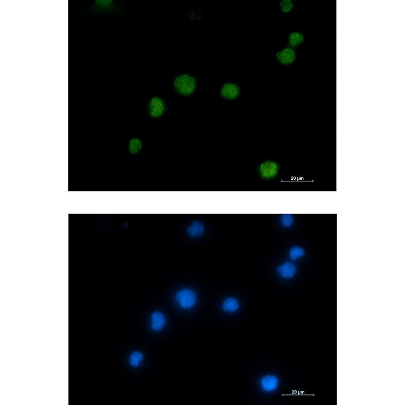 HMGB2 Rabbit Monoclonal Antibody
