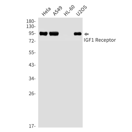 IGF1 Receptor Rabbit Monoclonal Antibody