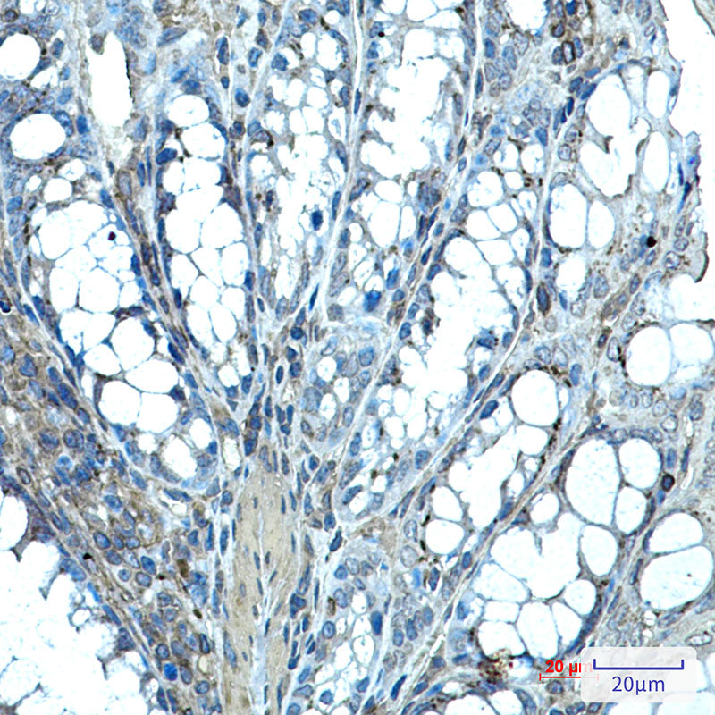Ihh Rabbit Monoclonal Antibody