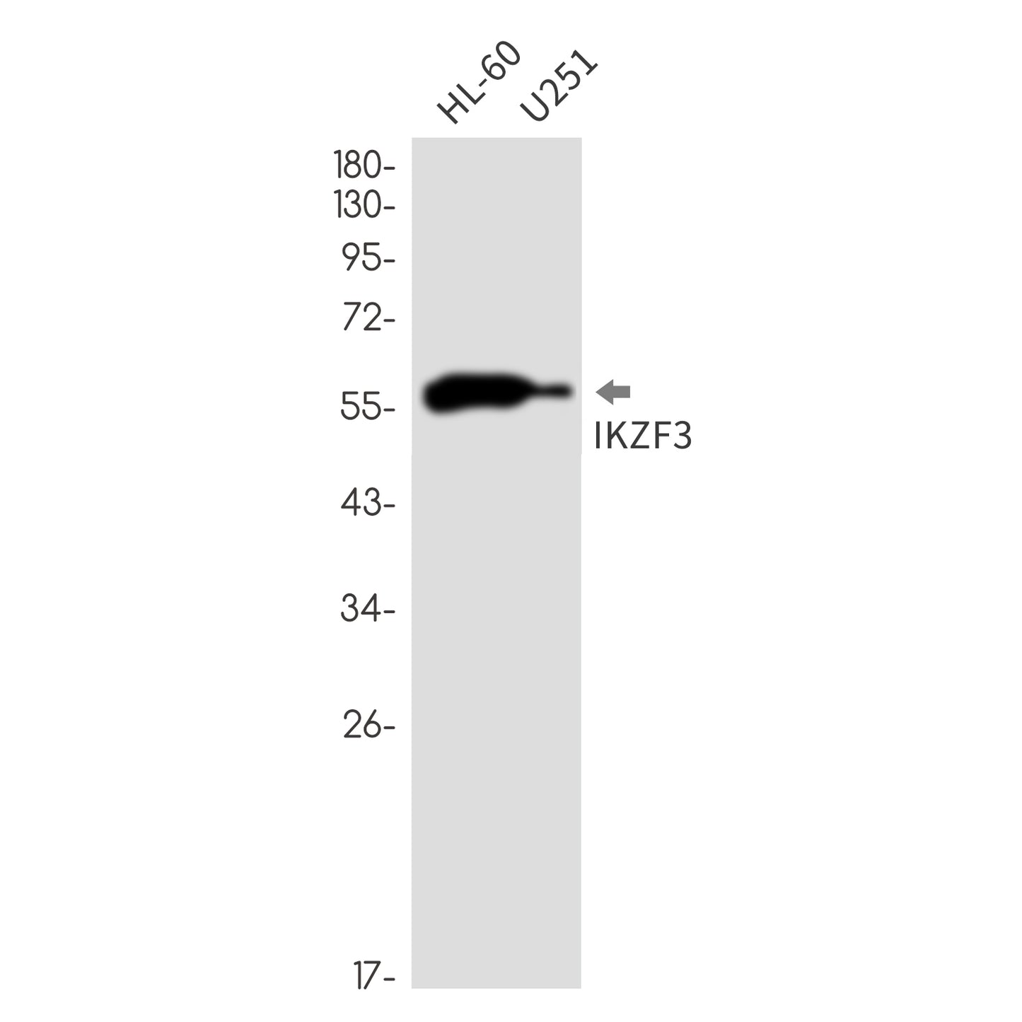 IKZF3 Rabbit Monoclonal Antibody