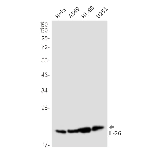 IL-26 Rabbit Monoclonal Antibody