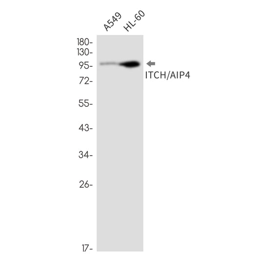 ITCH Rabbit Monoclonal Antibody