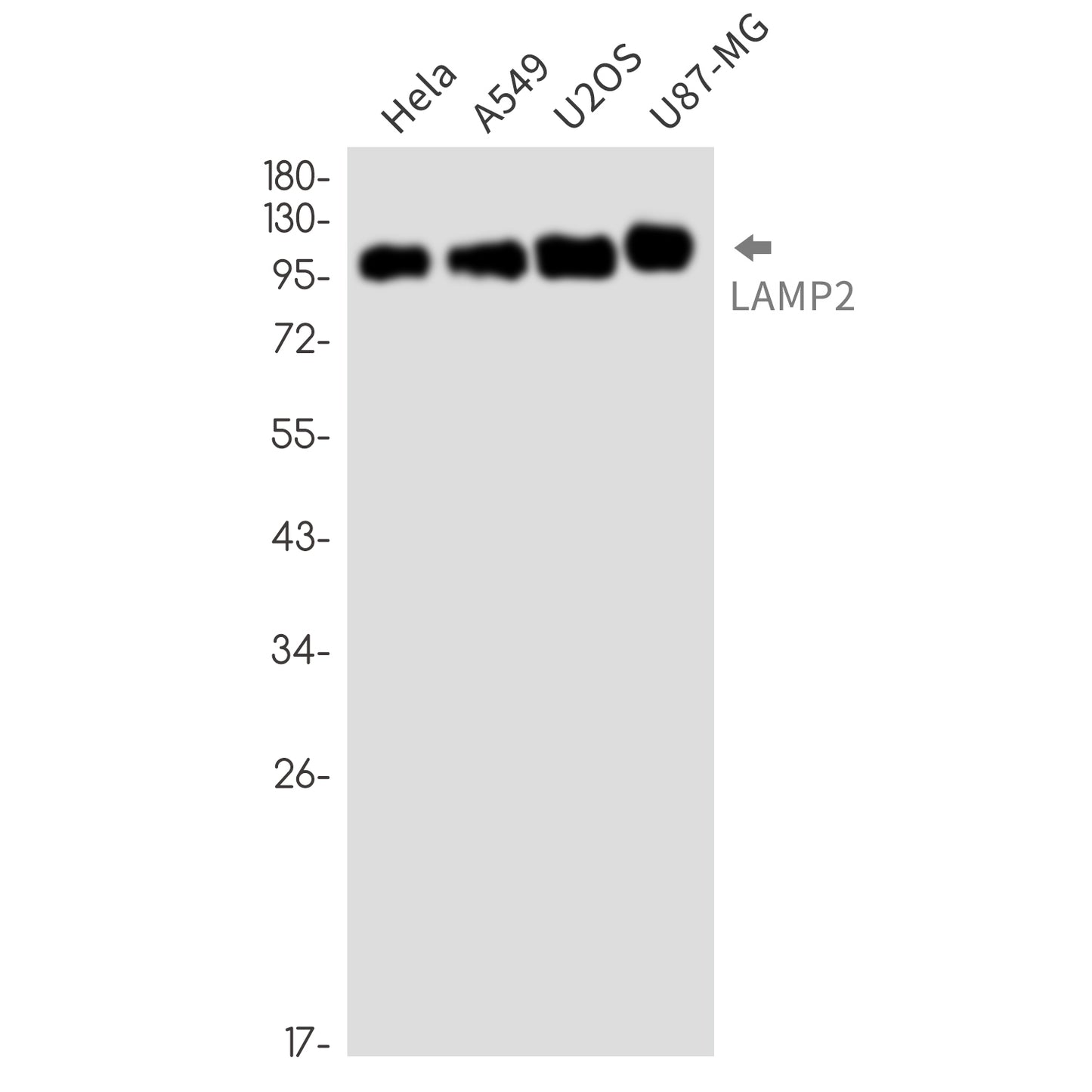 LAMP2 Rabbit Monoclonal Antibody