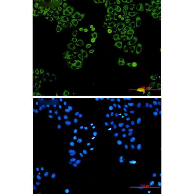 LYRIC Rabbit Monoclonal Antibody