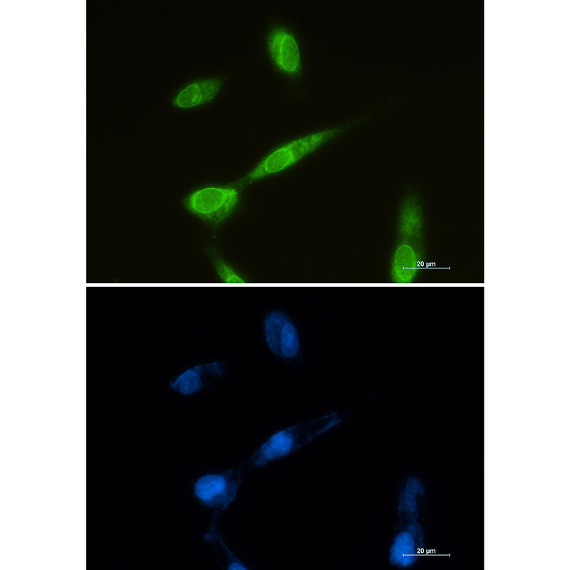 LYRIC Rabbit Monoclonal Antibody