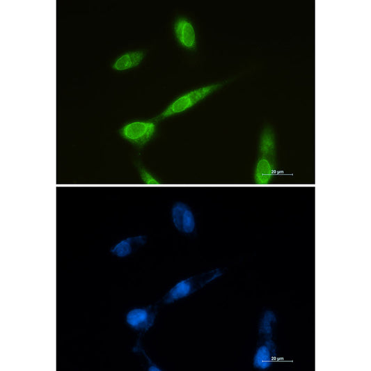 LYRIC Rabbit Monoclonal Antibody