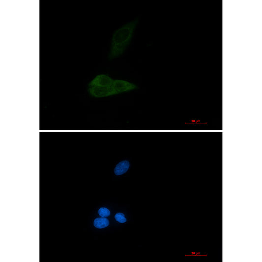 MAP3K4 Rabbit Monoclonal Antibody
