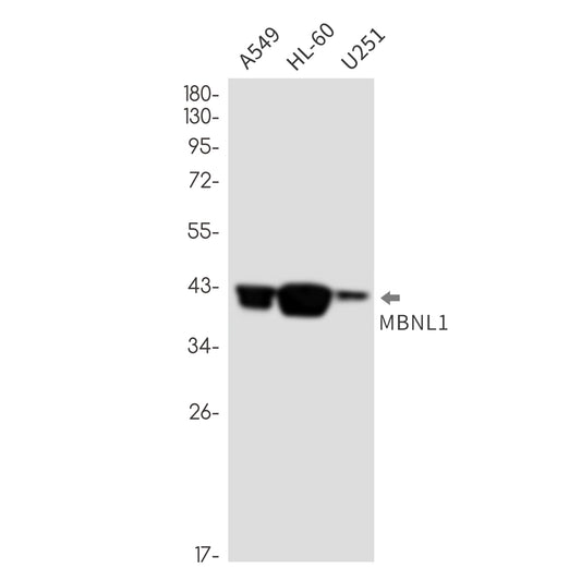 MBNL1 Rabbit Monoclonal Antibody