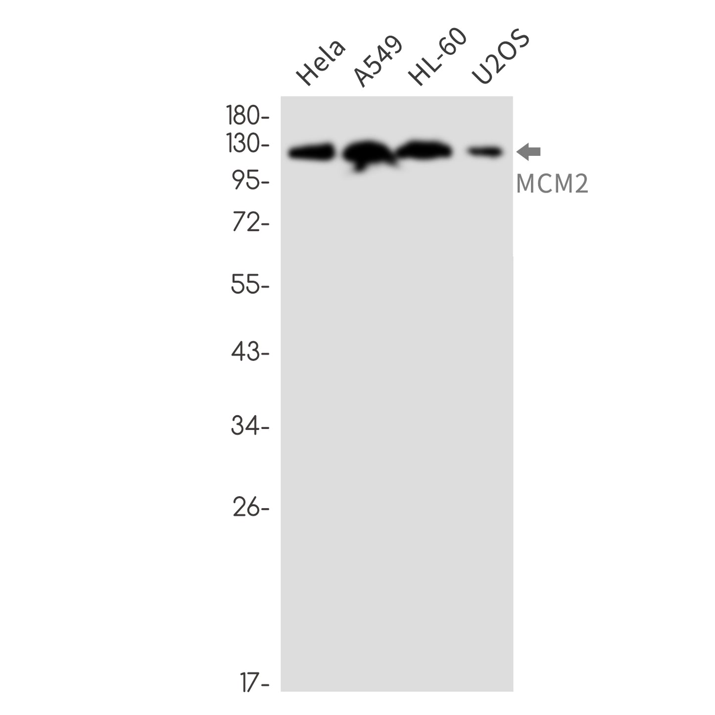 MCM2 Rabbit Monoclonal Antibody